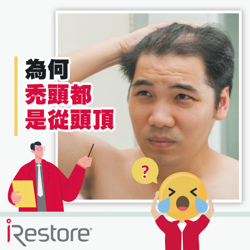 iRestore雷射生髮帽-衛生教育文章