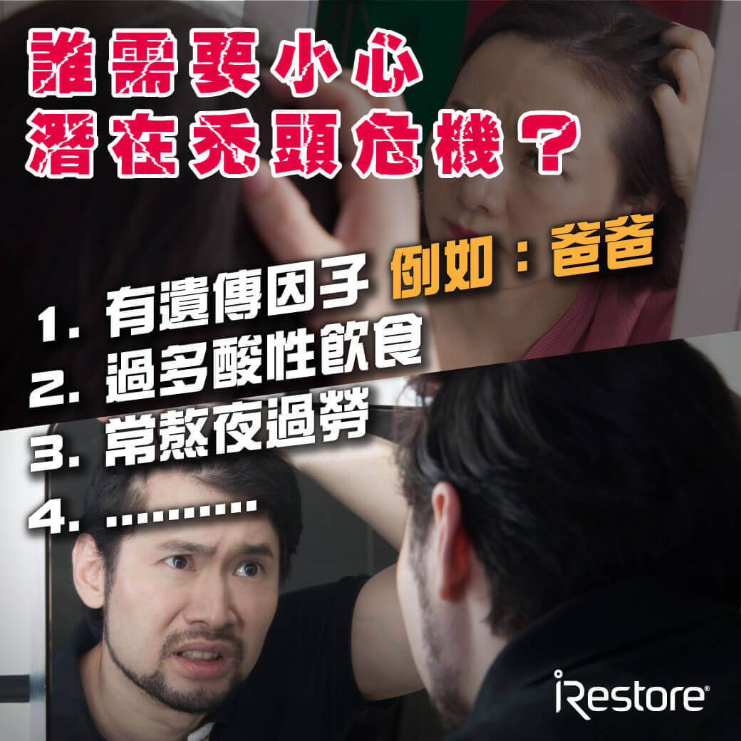 iRestore雷射生髮帽-衛生教育文章